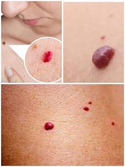 If you notice small red dots on your skin