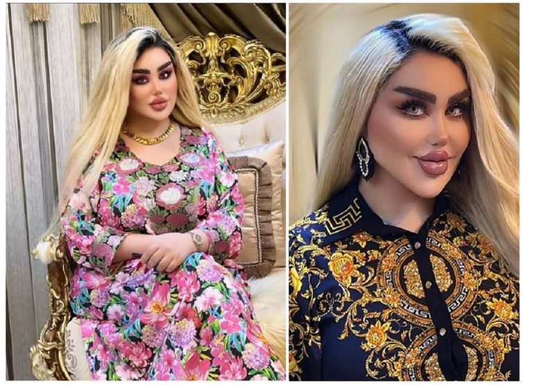 43 Surgeries To Look Like A Doll Spark