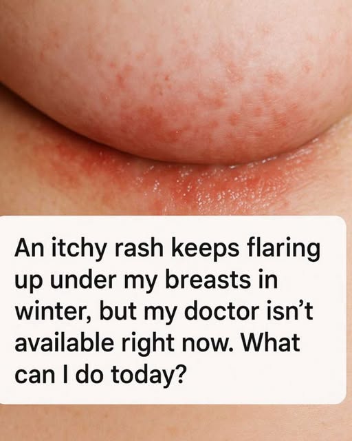 Itchy Rashes Under Your Breasts