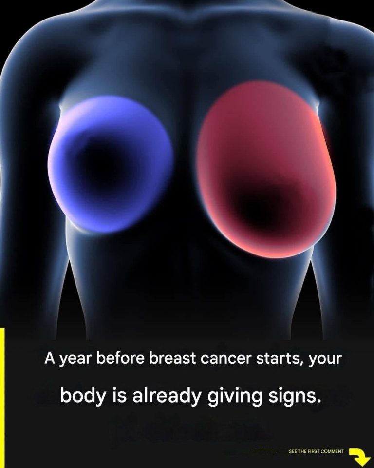 Breast can cer: 4 early si