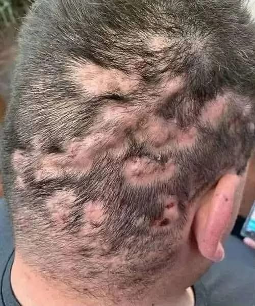 These are the first symptoms