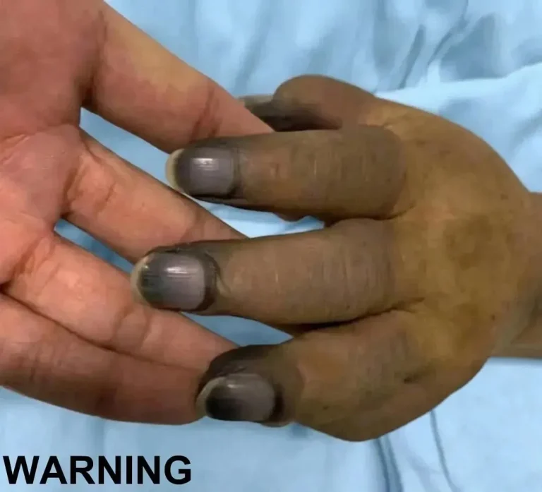These are the consequences of painting