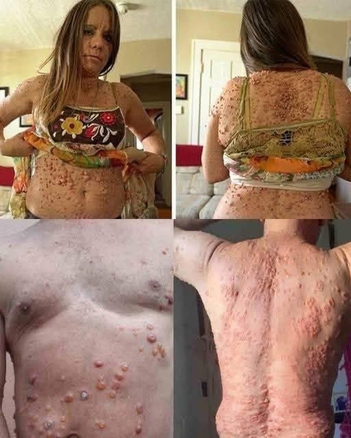 Sleeping Conditions That Can Quietly Destroy Your Skin