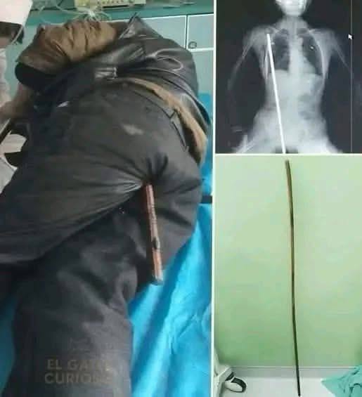 Young man hospitalized after be