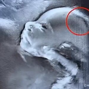 Doctors couldn’t believe what they saw durin