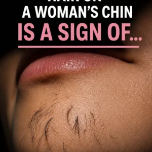 Why Chin Hair Grows in Women and What It M